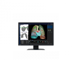 MONITOR REVISIÓN MÉDICA EIZO MX243W RADIFORCE