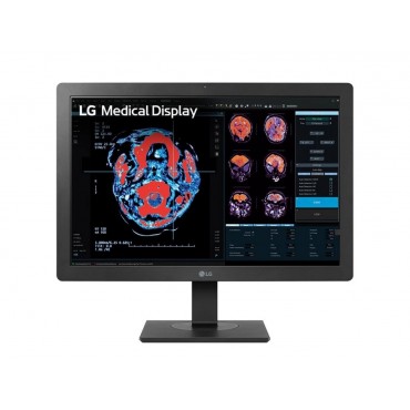 MONITOR REVISIÓN CLÍNICA LG 24HR513C