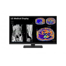 MONITOR REVISIÓN CLÍNICA LG 27HS713C