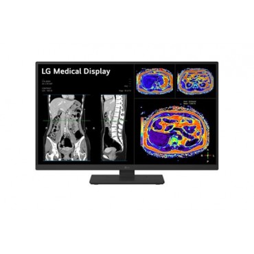 MONITOR REVISIÓN CLÍNICA LG 27HS713C