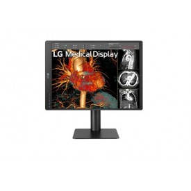 MONITOR REVISIÓN CLÍNICA LG 21HQ513D