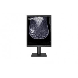 MONITOR DE DIAGNÓSTICO LG 21HQ613D