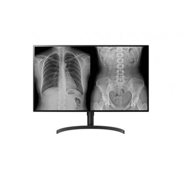 MONITOR DE DIAGNÓSTICO LG 32HL512D