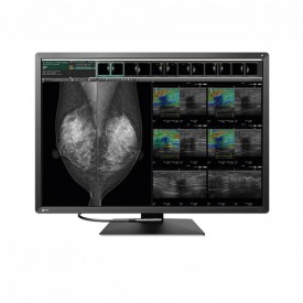 MONITOR DIAGNÓSTICO MÉDICO EIZO RX1270 RADIFORCE