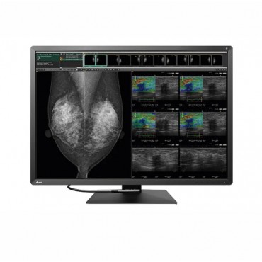 MONITOR MAMOGRAFÍA EIZO RX1270 RADIFORCE