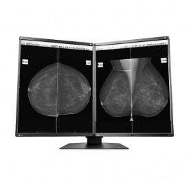 MONITOR DIAGNÓSTICO MÉDICO EIZO GX560-MD RADIFORCE