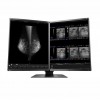 MONITOR DIAGNÓSTICO MÉDICO EIZO RX560-MD RADIFORCE