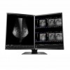 MONITOR MAMOGRAFÍA EIZO RX560-MD RADIFORCE