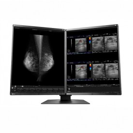 MONITOR DIAGNÓSTICO MÉDICO EIZO RX560-MD RADIFORCE