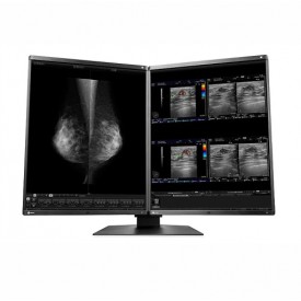 MONITOR MAMOGRAFÍA EIZO RX560-MD RADIFORCE