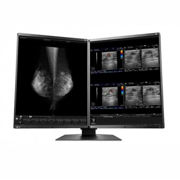 MONITOR MAMOGRAFÍA EIZO RX560-MD RADIFORCE
