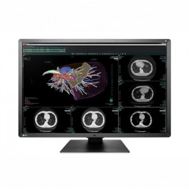 MONITOR DIAGNÓSTICO MÉDICO EIZO RX660 RADIFORCE