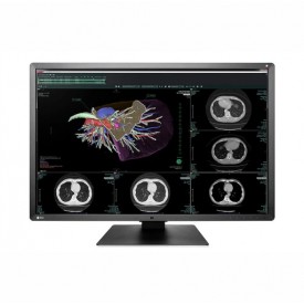 MONITOR RADIOGRAFÍA TÓRAX EIZO RX660 RADIFORCE