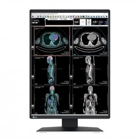 MONITOR DIAGNÓSTICO MÉDICO EIZO RX370 RADIFORCE