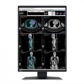 MONITOR RADIOGRAFÍA TÓRAX EIZO RX370 RADIFORCE
