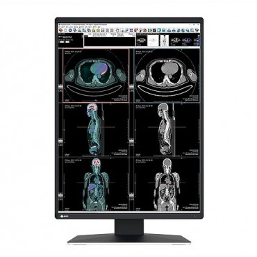 MONITOR RADIOGRAFÍA TÓRAX EIZO RX370 RADIFORCE