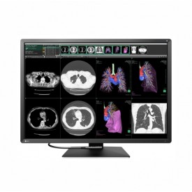 MONITOR TÓRAX EIZO RX1270 RADIFORCE