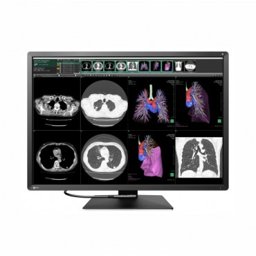 MONITOR TÓRAX EIZO RX1270 RADIFORCE
