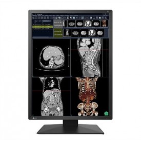 MONITOR REVISIÓN MÉDICA EIZO RX270 RADIFORCE