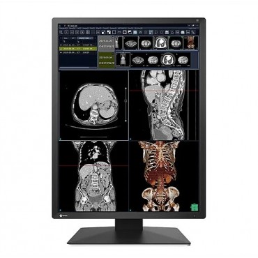 MONITOR REVISIÓN MÉDICA EIZO RX270 RADIFORCE