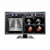 MONITOR REVISIÓN MÉDICA EIZO MX315W RADIFORCE