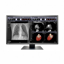MONITOR REVISIÓN MÉDICA EIZO MX315W RADIFORCE