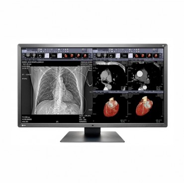 MONITOR REVISIÓN MÉDICA EIZO MX315W RADIFORCE