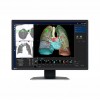 MONITOR REVISIÓN MÉDICA EIZO MX243W RADIFORCE