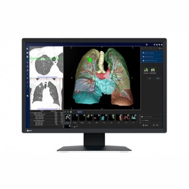 MONITOR REVISIÓN MÉDICA EIZO MX243W RADIFORCE