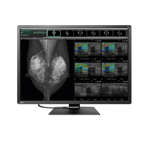 Monitor Mamografía EIZO RX1270 RadiForce
