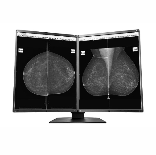 Monitor Mamografía EIZO GX560-MD RadiForce