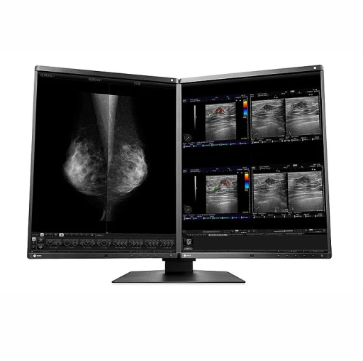 Monitor Mamografía EIZO RX560-MD RadiForce