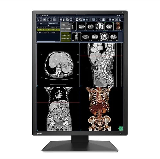 Monitor Diagnosis de Sección EIZO TC/IRM RX270 RadiForce