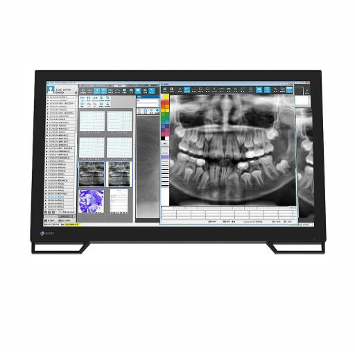 Monitor Radiografía Clínica Dental EIZO MS236WT-A RadiForce
