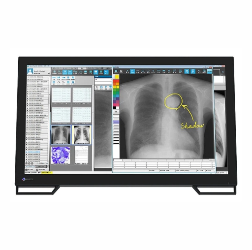 Monitor Ortopedia EIZO MS236WT-A RadiForce